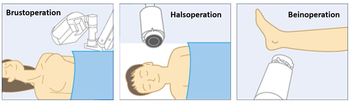 Freely Adjustable Camera Positioning