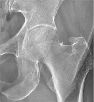 Smart Noise Reduction